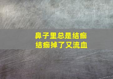 鼻子里总是结痂 结痂掉了又流血